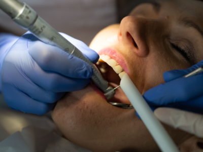 implanty zębów Radom, Implanty zębów <span>Radom</span>